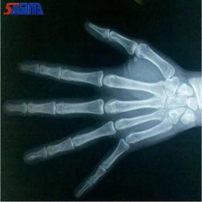 Medical Products Waterproof Printing X-ray Film Inkjet Film