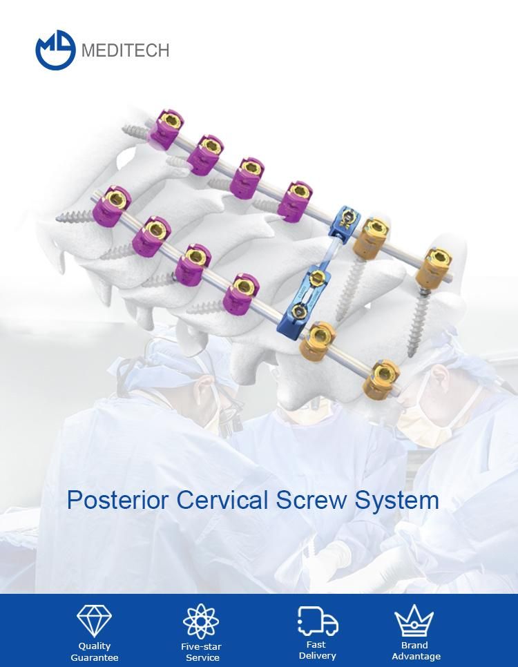 Orthopedic Implants Titanium Posterior Cervical Fixation System for Spine Surgery