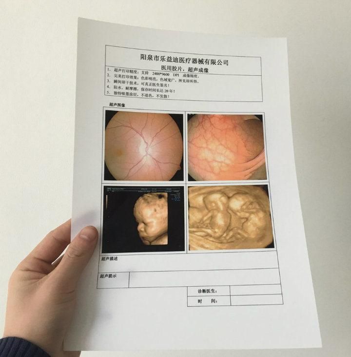 Lowest Cost Solution Ultrasound Dept. Inkjet Dry Blue Medical X Ray Film