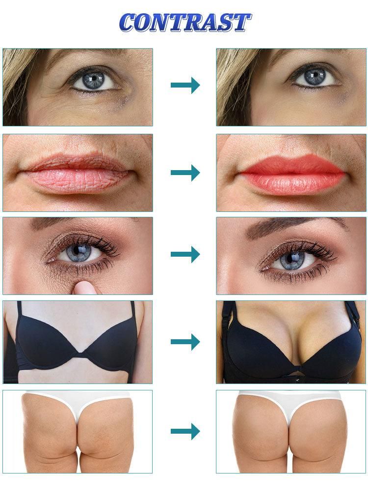 Breast Increase Implant Injections Hyaluronic Acid Growth Injection