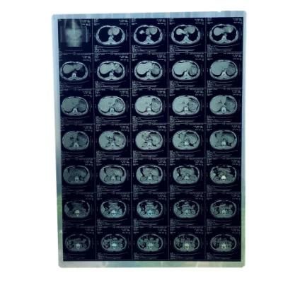 11*14 and 14*17 Inch X-ray Medical Pet Inkjet Blue Films