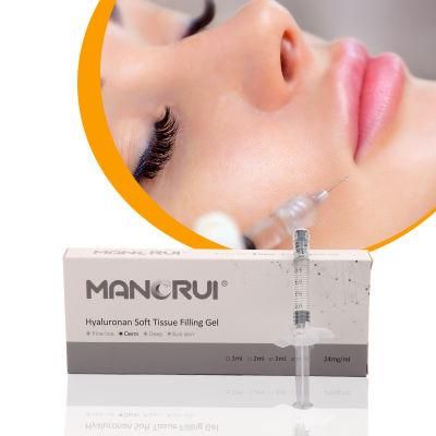 Short Recovery Period Hyaluronic Acid Lip Filler Injection Injectable Dermal Filler 2ml