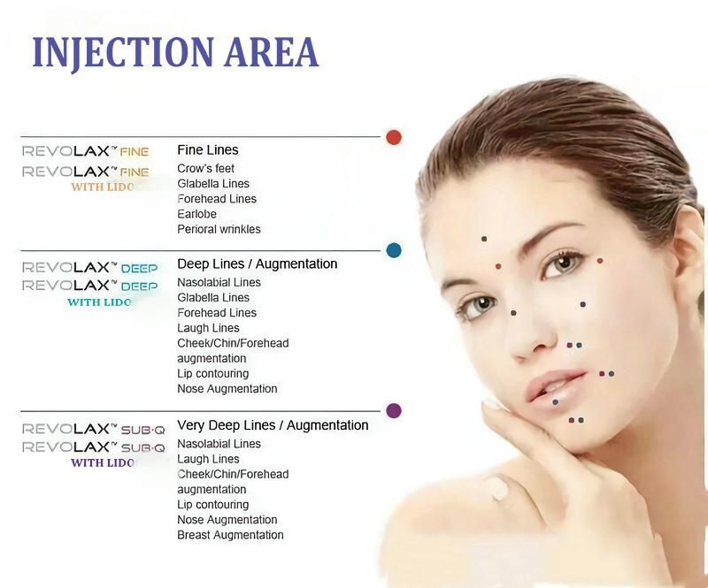 Apply Facial Folds High Quality Acid Dermal Injectable Ha Gel Filler