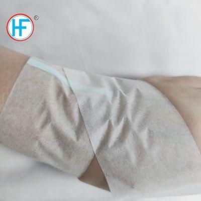 Mdr CE Approved Hot Sale Medical Instrument White or Skin Paper and Nonwoven Tape