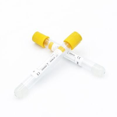 Disposable Vacuum Gel&Clot Activator Sst Blood Collection Tube Yellow Cap
