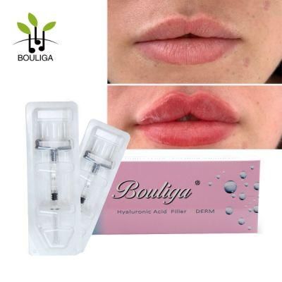 Bouliga Cross-Linked Medium Hyaluronic Acid Filler Injectable Gel Ha Filler