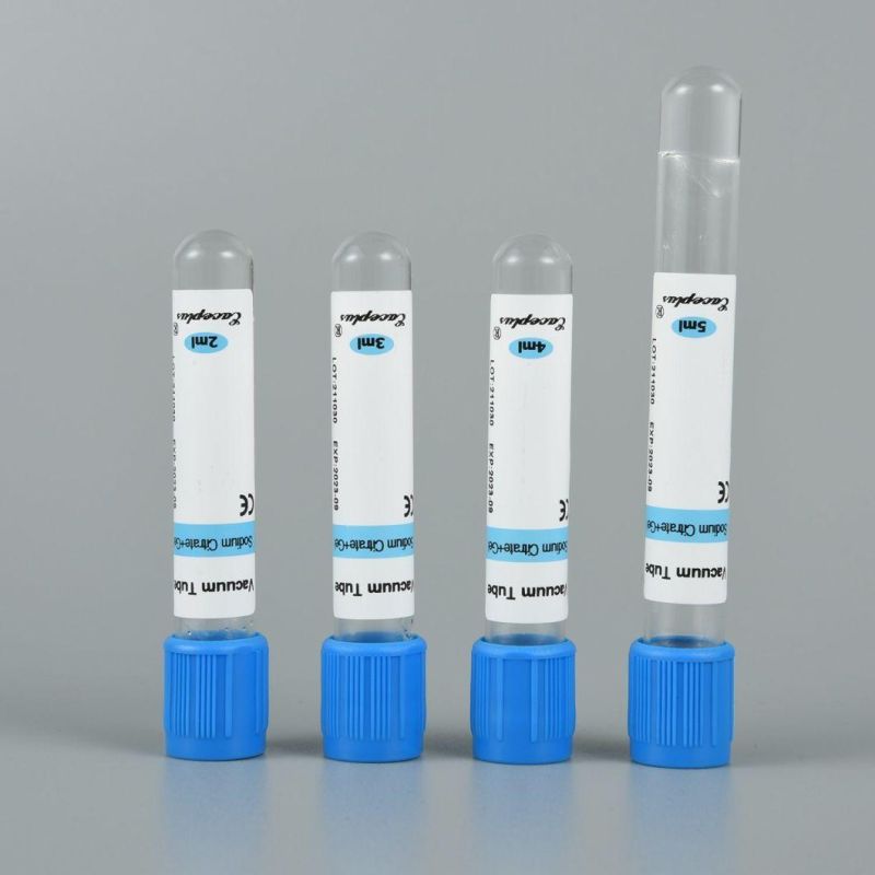 Siny Blue Cap Gel&Sodium Citrate PT Plain Vacuum Blood Collection Tube with CE