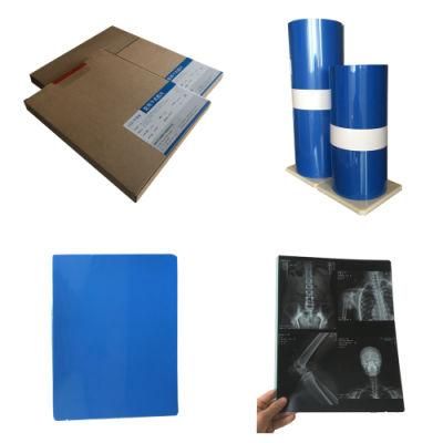 X Ray Thermal/Inkjet Film Medical Images for Clinic and Hospitals