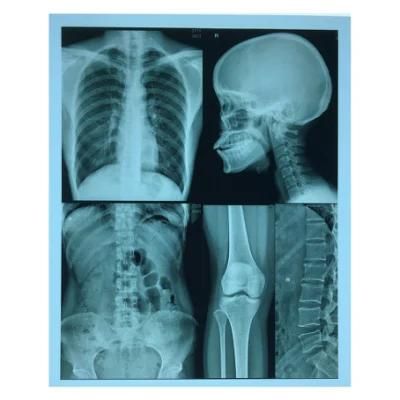 10X12 Inch A4 A3 CT Cr Pet Radiology Blue Medical Inkjet Film