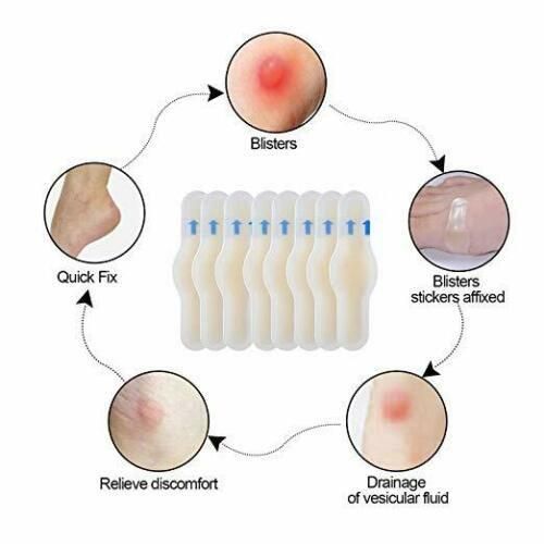 Medical Surgical Adhesive Hydrocolloid Wound Dressing