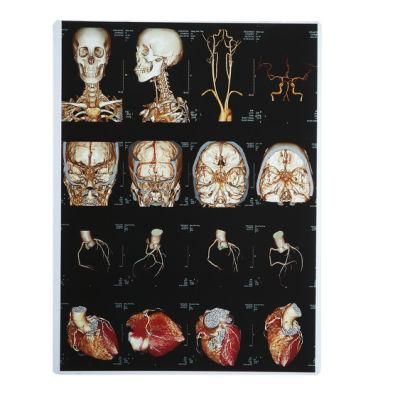 8X10 X-ray Medical Film Hospital for Canon Epson Inkjet Printing