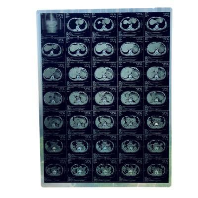 Blue Color 8*10 Inch Medical Dry Imaging Film