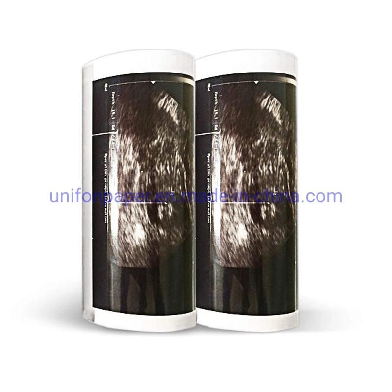 Ultrasound Thermal Paper Upp 110s for Sony Video Thermal Printer