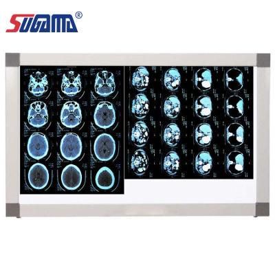 Medical X Ray Film Blue Wet Type Sensitive