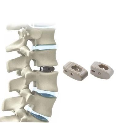 Orthopedic Medical Products Spine Implants Plif Lumbar Cage