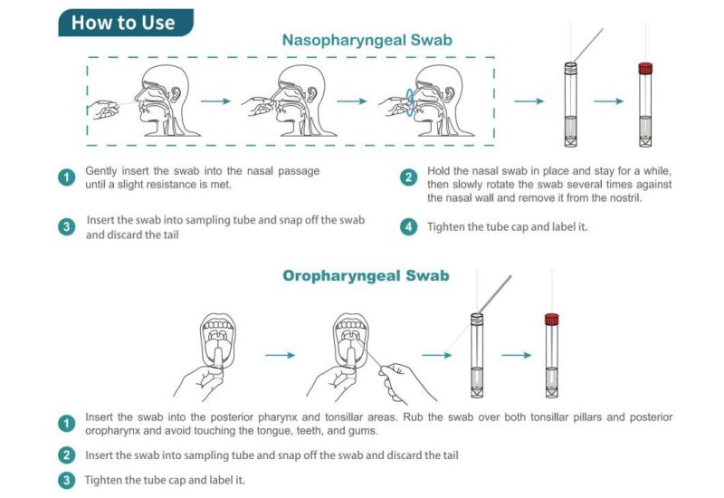 CE FDA Medical Disposables Sterile Oral Oropharyngeal Nasal Nasopharyngeal Sampling Kits Throat Nose Collection Vtm Swab for PCR Rapid Diagnostic Test