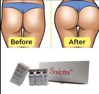 Best Seller Sculptr Results After 2 Weeks Sculptr Before and After Jowls Sculptr Hip Dips Breast Buttock Enlargment Injcetions