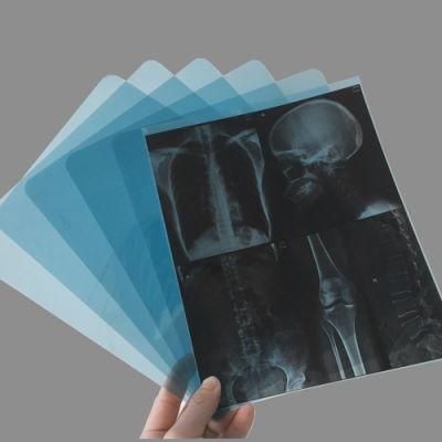 8*10 Blue Inkjet Film Medical X-ray Equipments &amp; Accessories 210 Microns Pet Rolls