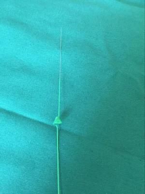 Reborn Medical Stone Ureteral Cone Bolcking Coil F3with CE Certificate