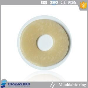 Moudable Hydrocolloid Seal Ring to Fill Uneven Skin Surface Around Ostomy