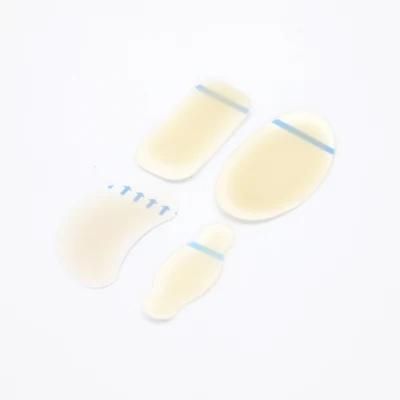 Hydrogel Wound Dressing Hydrogel Wound Hydrocolloid Wound Dressing