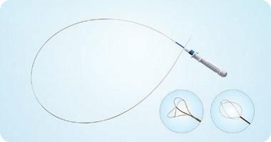 Tipless Nitinol Core Stone Retrieval Basket