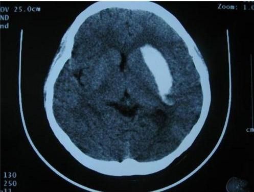 CT Dr MRI Laser Medical X-ray Printing Film