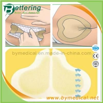 Medical Advanced Thin Border for Sacrococcyx Hydrocolloid Dressing