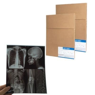 28*35 Cm Thermal X-ray Film for Thermal Medical Dry Imager