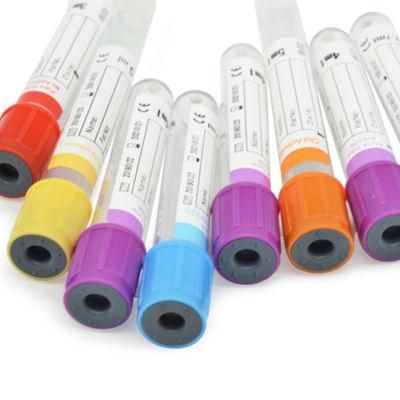 Disposable High Quality Glass or Plastic Blood Collection Tube with Good Price