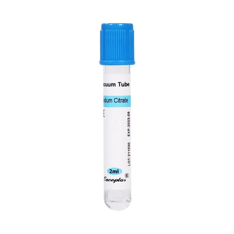 Siny Sst Disposable Vacuum Blood Collection Tube with Sodium Citrate