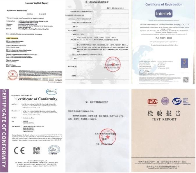 A4 Inkjet Dry Films for Ultrasound Canon C5535I Printer