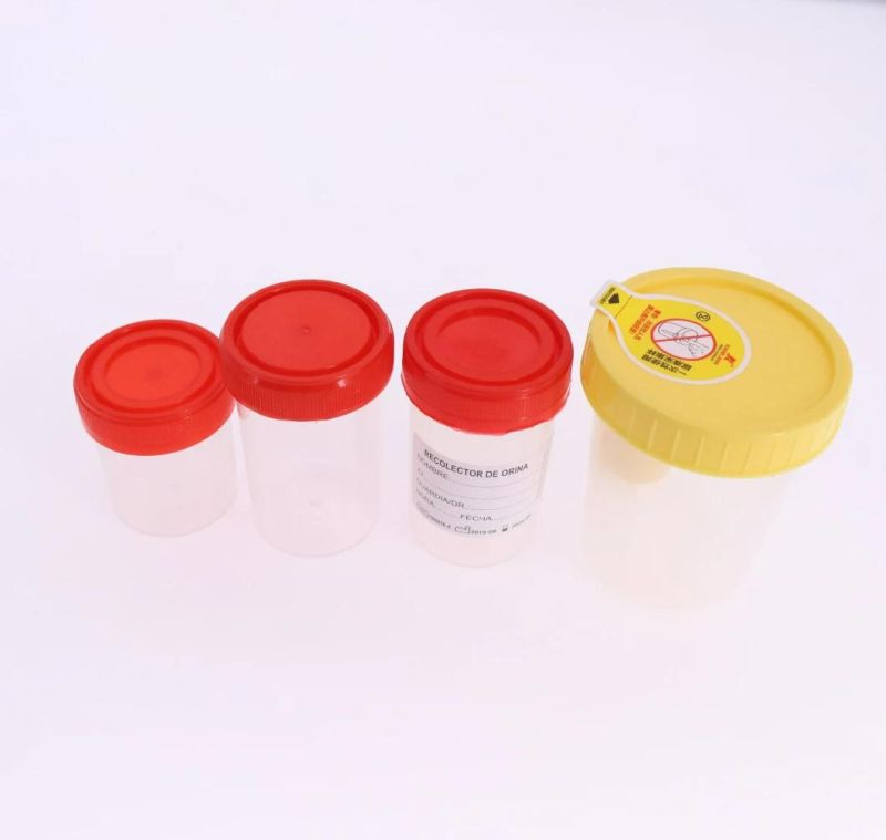 Disposable Urine Cup Vacuum Urine Specimen Container Cup