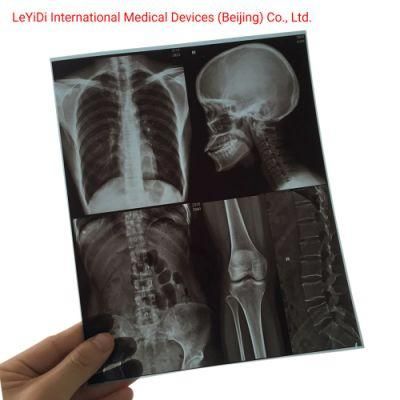 High Brightness Clear Medical Radiography Dry X-ray Inkjet Film