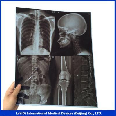 Radiology X-ray Film Thermal Blue Sensitive Media