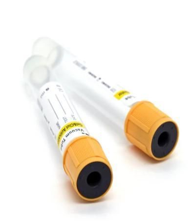 Gel Tube, with Clot Activator, Gel&Clot Activator Vacuum Blood Collection Tube, Yellow Cap