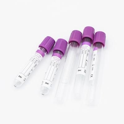 EDTA Vacuum Blood Collection Tube with CE Approval