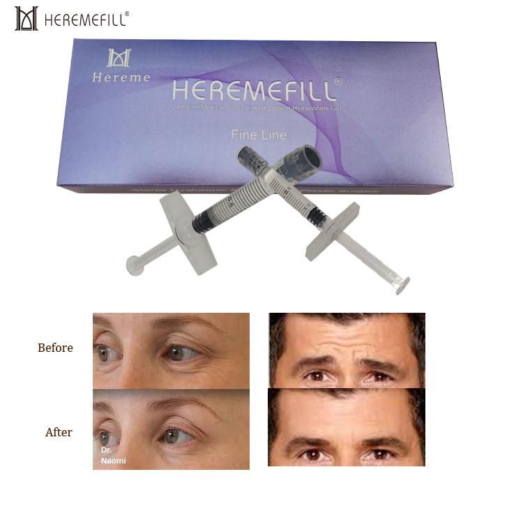 Heremefill High Quality Double Cross-Linked Hyaluronic Acid Dermal Filler to Remove Wrinkles and Crow′s Feet Dermal Filler