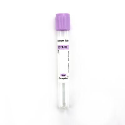 Siny EDTA Vacuum Draw Blood Test Collection Tubes 13*75mm 2ml 3ml with CE