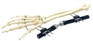 Orthopedic Wrist Joint External Fixation