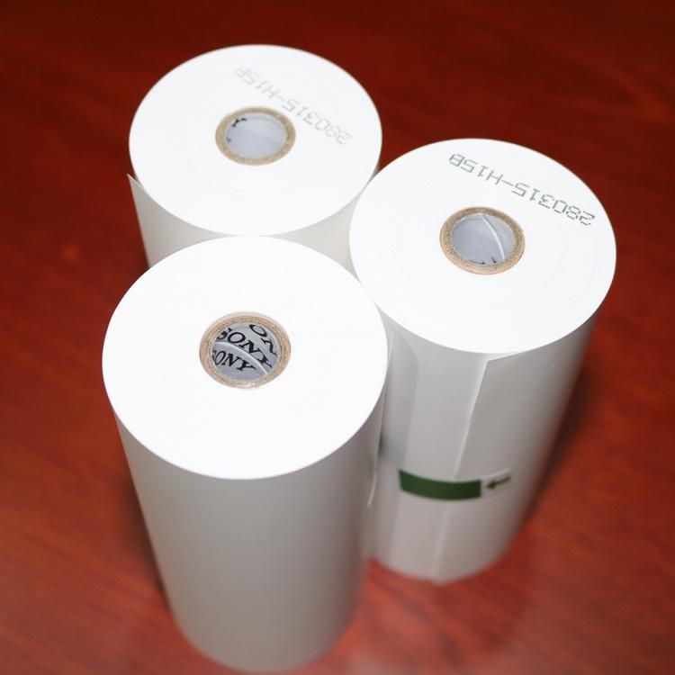 Ultrasound Video Printer Use Thermal Printing Paper Paper Roll for Thermal Printing