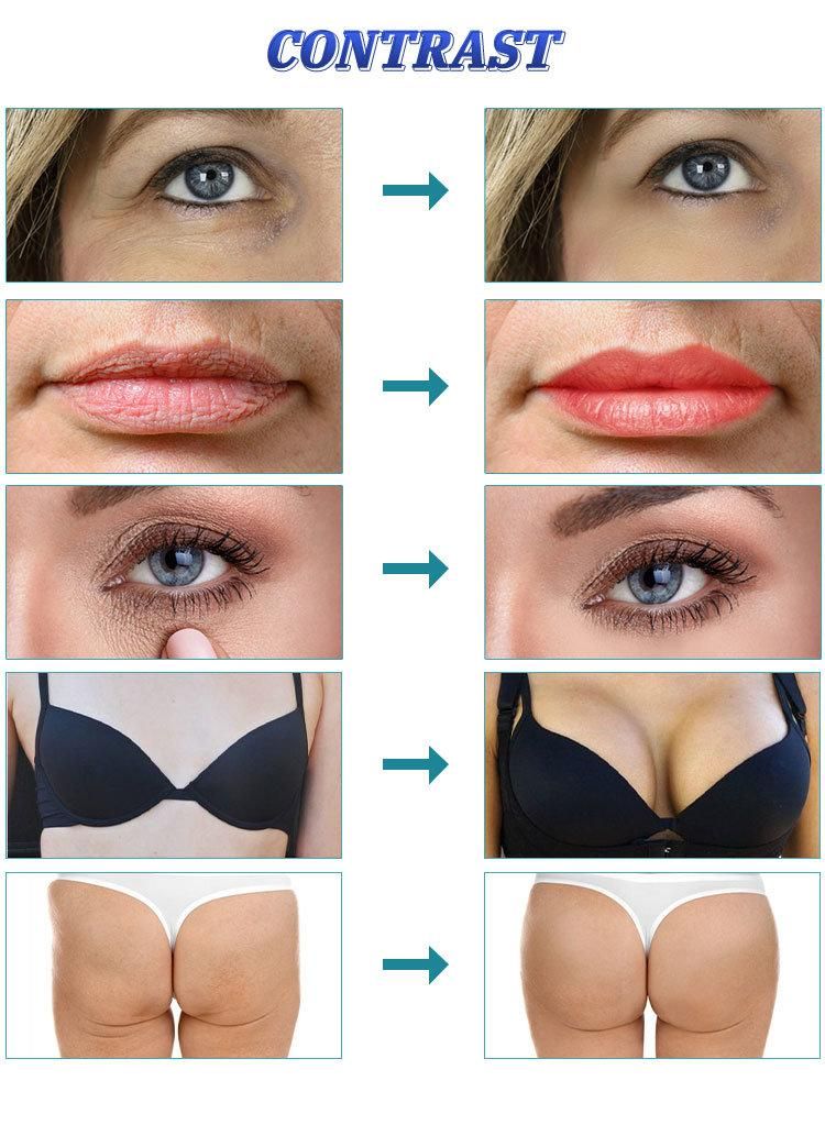 10ml 20ml Injectable Ha Injection Butt Enlargement Penis Dermal Filler