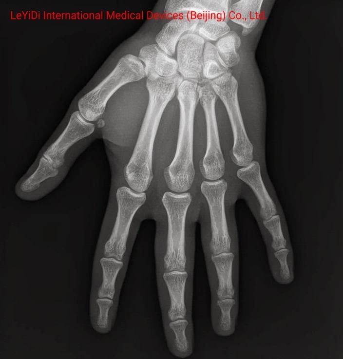 Low Price Color Printing Medical X-ray Film