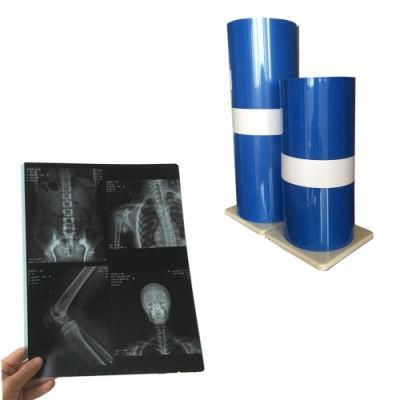 Manufacture Roll Packing Medical Dental Transparent Blue PE Film