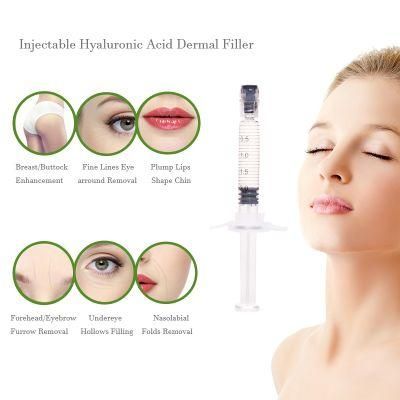 Hyaluronic Acid Gel Injection Cosfiller Dermal Filler for Cheek Marionettes Lines