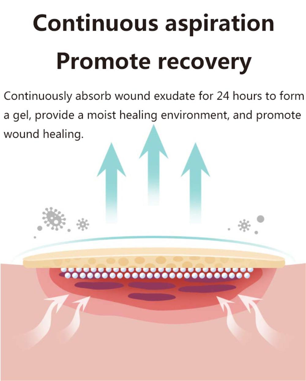 Hydrocolloid Wound Dressing Advanced Wound Care Dressing