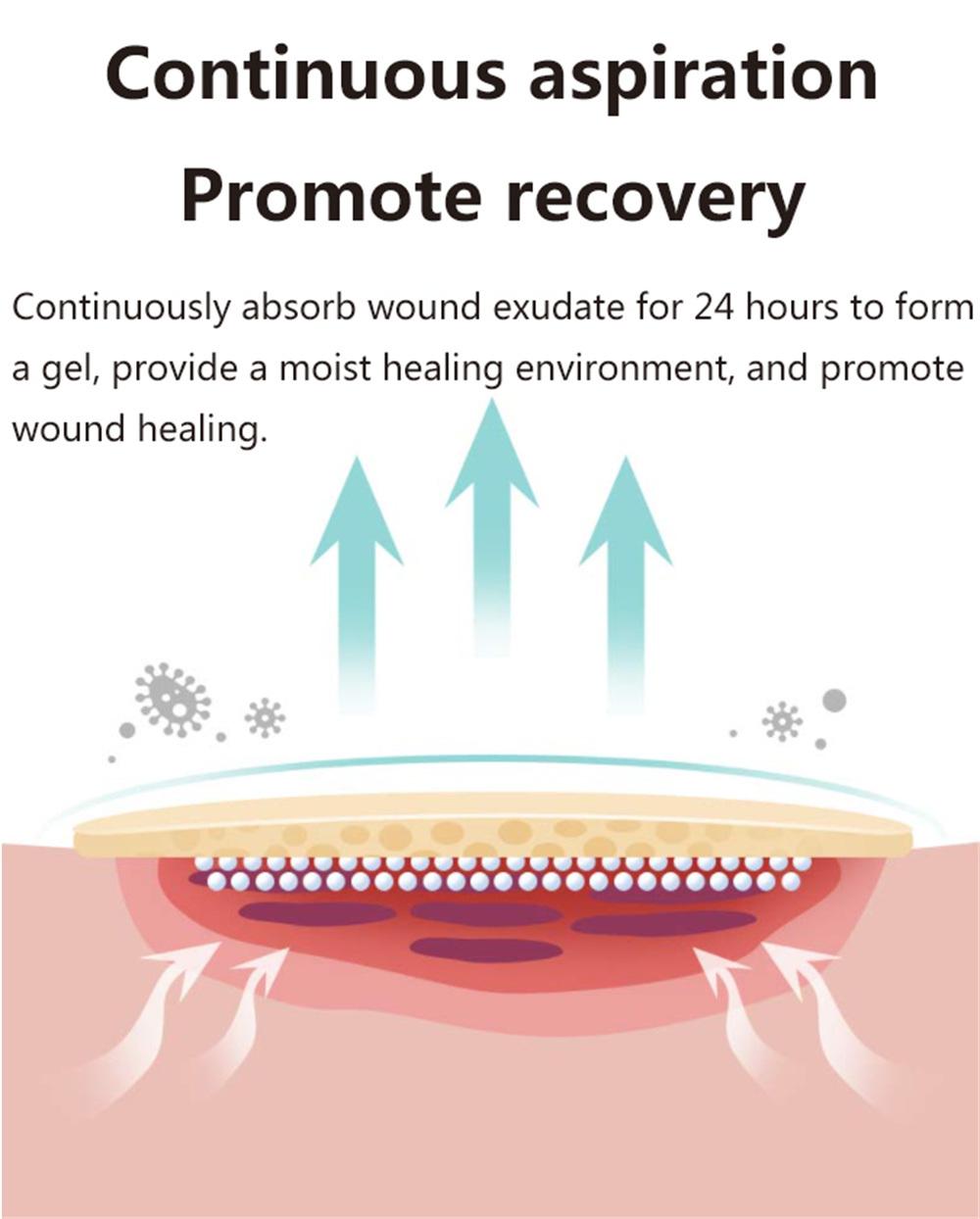 Disposable First Aid Adhesive Advanced Hydrocolloid Wound Dressing for Exuding Woundssterile