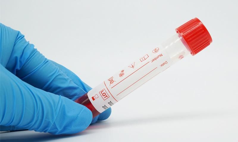 Sample Collection Kit PCR Test DNA Test Sample Collection Kit Standard Transmission Sampling Kit
