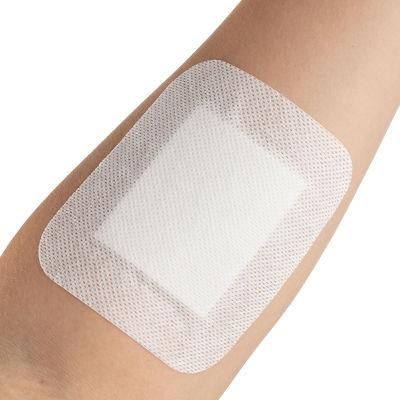 Disposable Non Woven Adhesive Sterile Dressing Pads for Wounds