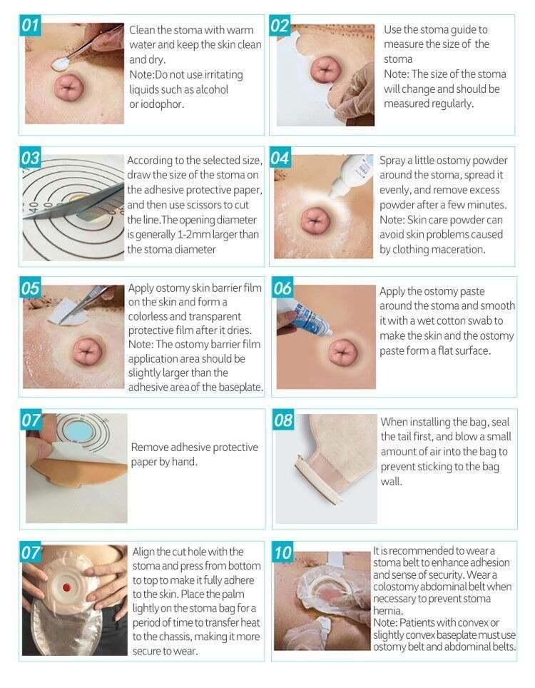 Disposable Medical Adult One Piece Ostomy Stoma Care Cover Colostomy Bag